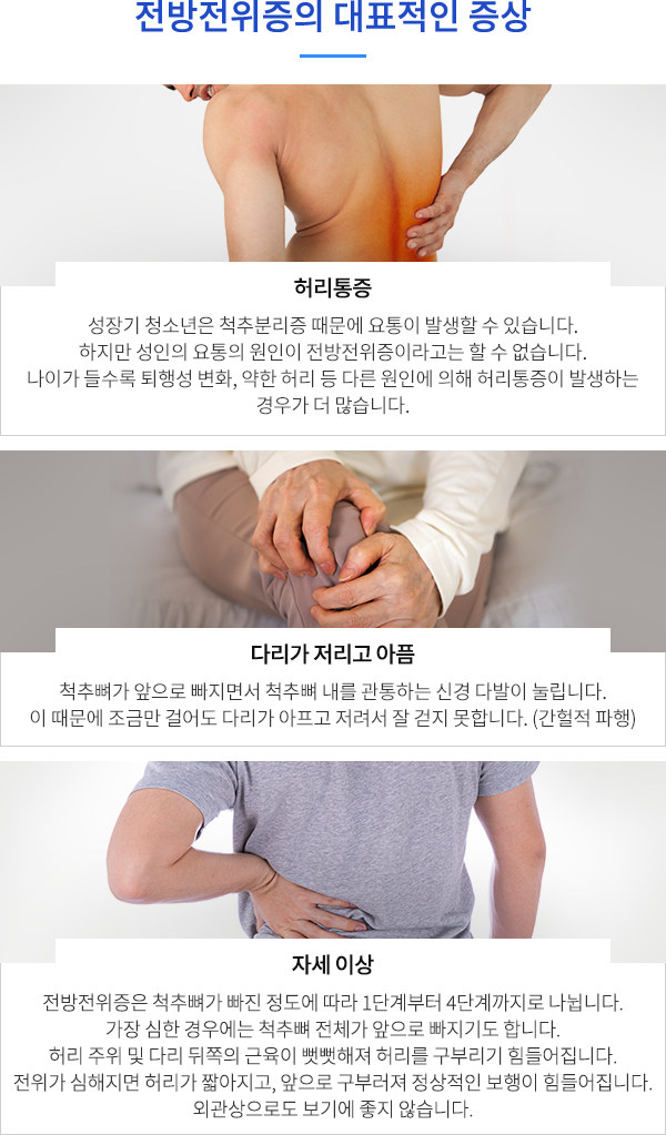 전방전위증의 대표적인 증상
