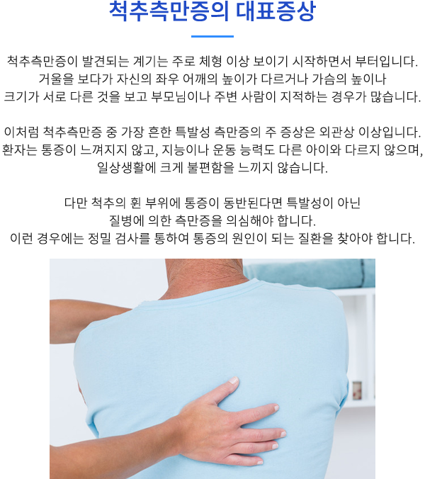 척추측만증의 대표증상