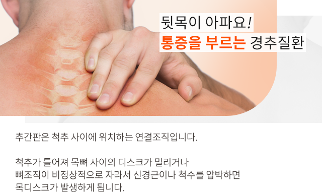 경추질환