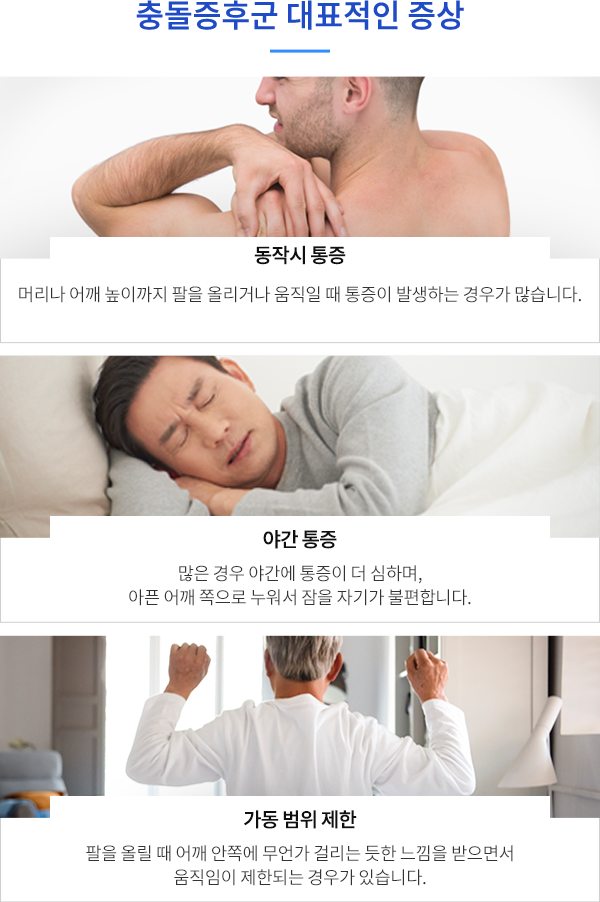 충돌증후군 대표증상