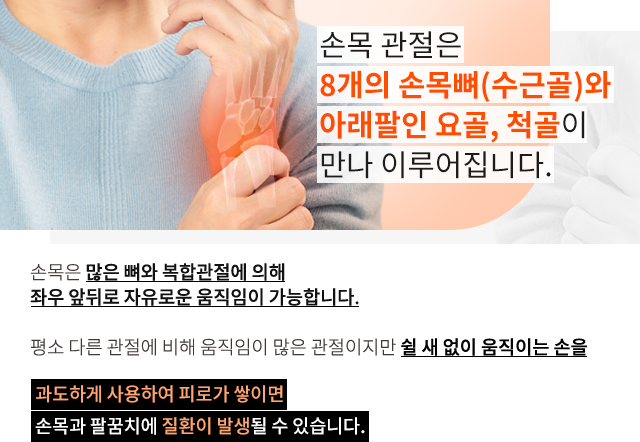 손목질환