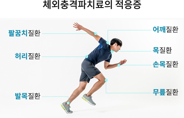 체외충격파치료의 적응중