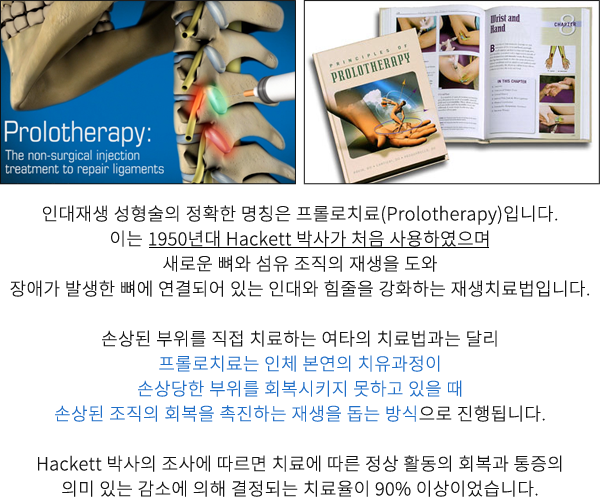 인대재생치료