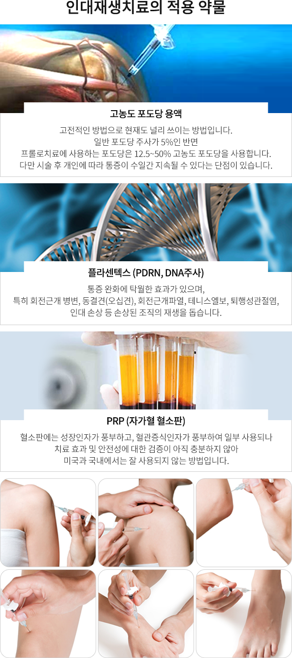 인대재생치료의 적용 약물